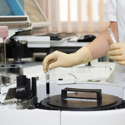 genetic compatibility test - Kuwait